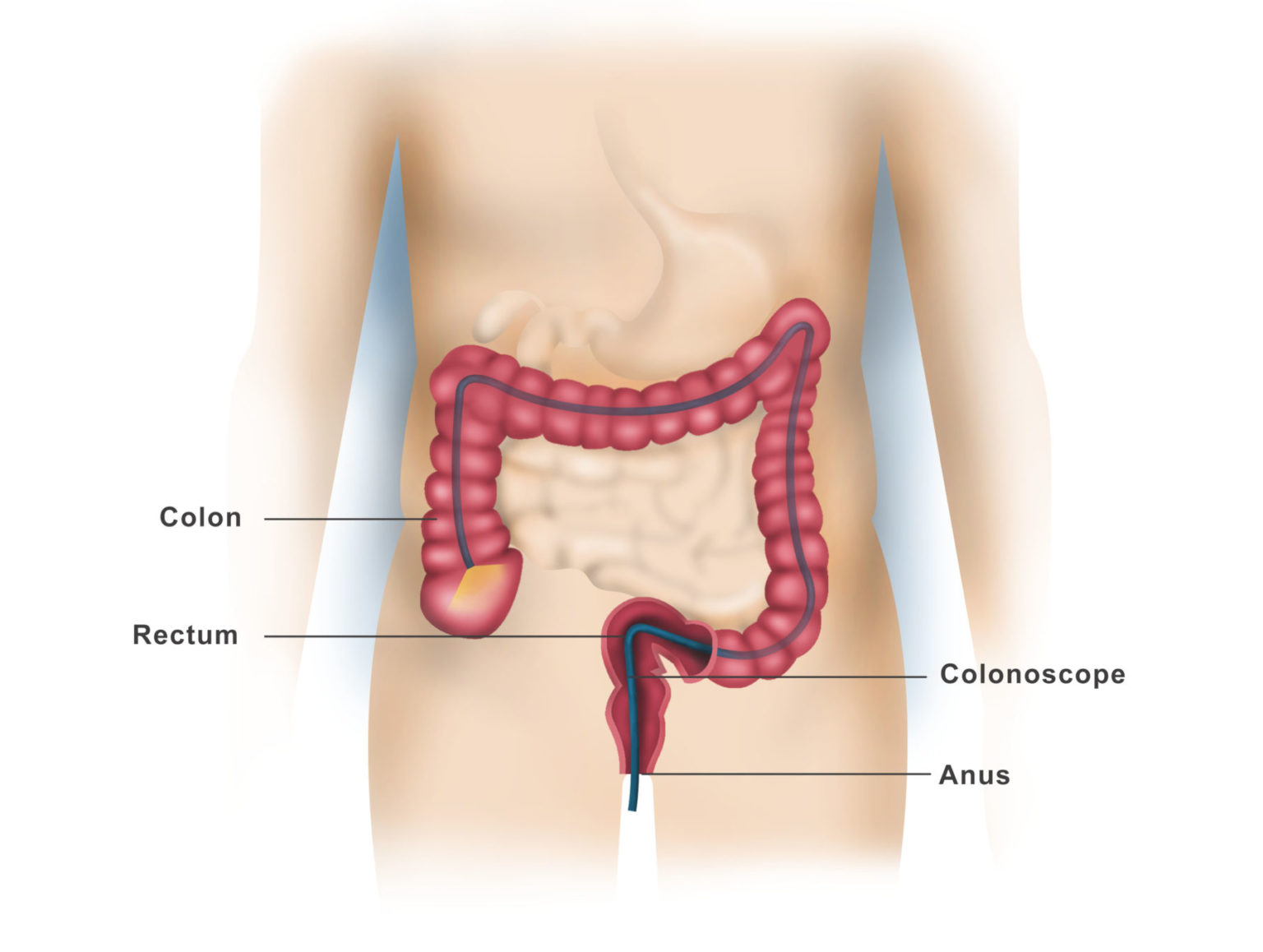 upper-and-lower-endoscopy-dr-ahmed-farah-abdulrahman