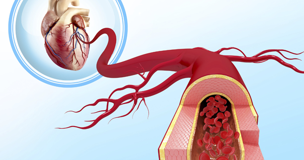 The image illustrates the anatomy of the carotid artery system. It features a close-up of a carotid artery branching into external carotid artery branches, highlighting the neck artery and common carotid artery. 