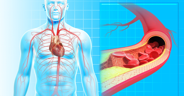 The image depicts a human body with an emphasis on the circulatory system, highlighting the carotid artery. It includes a close-up view of the neck artery, specifically showing the common carotid artery and its bifurcation into external carotid artery branches. 