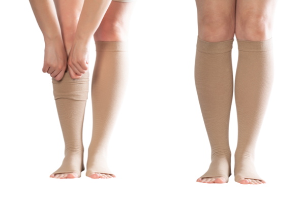 Image showing compression stockings, often recommended as part of varicose veins treatment Dubai to support recovery after sclerotherapy Dubai.